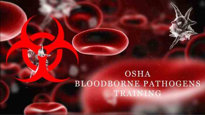 Bloodborne pathogens quiz true false